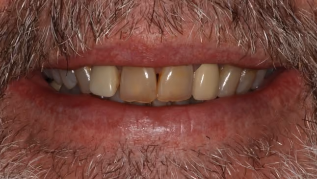 Before Image