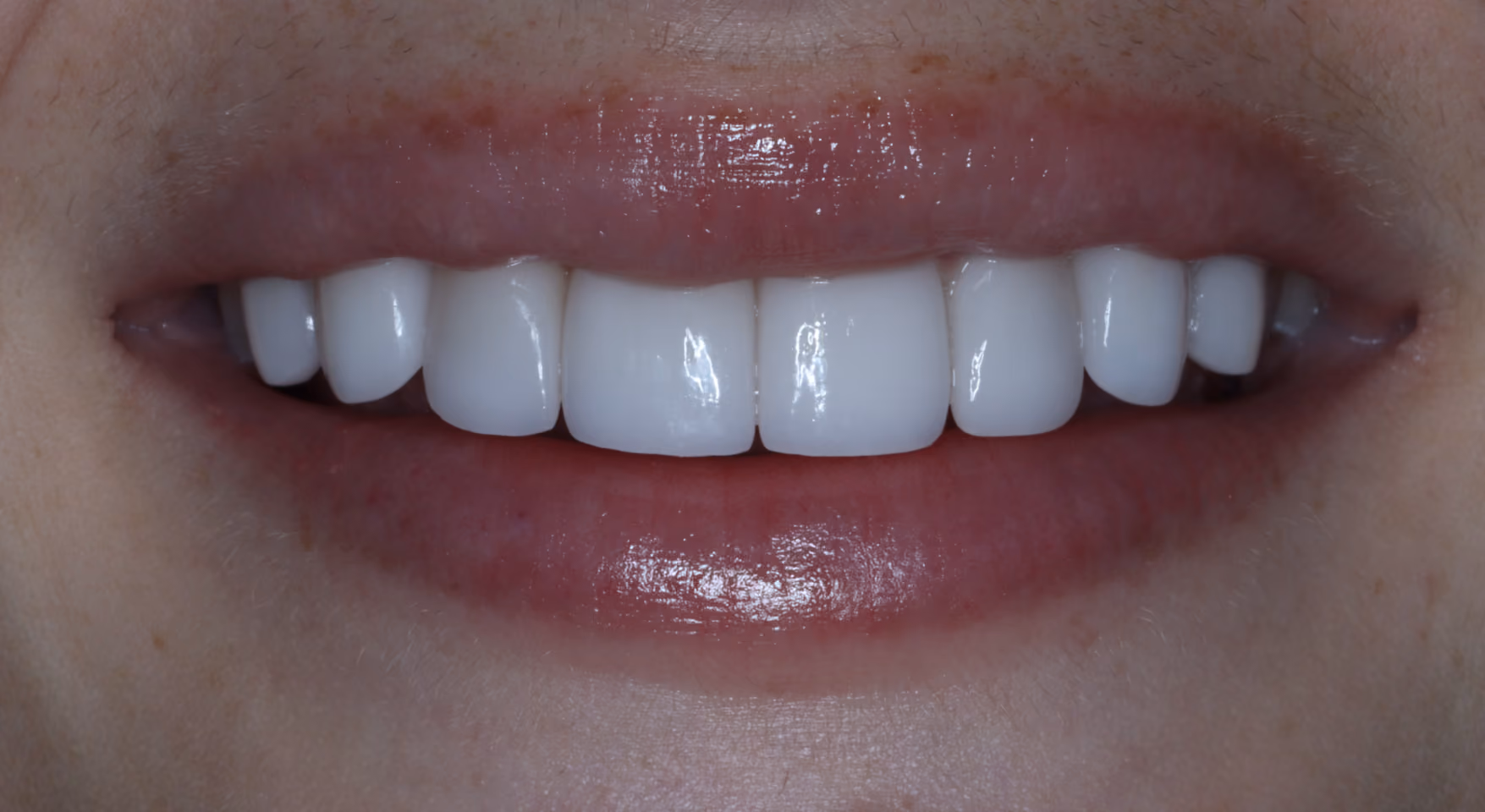 After Image