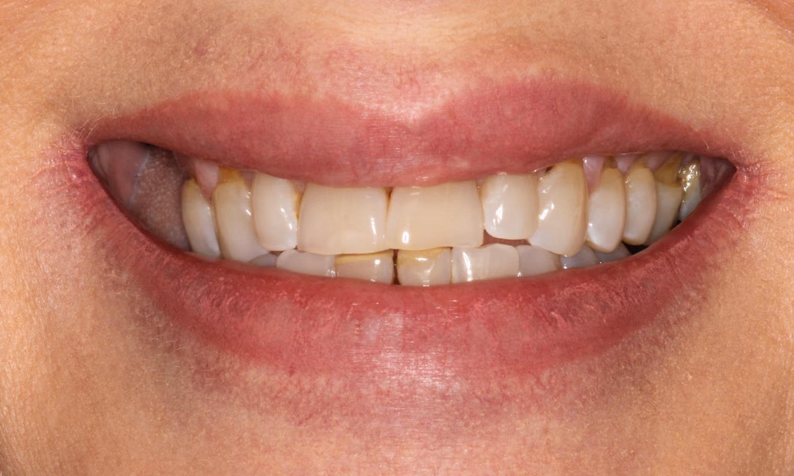 Before Image