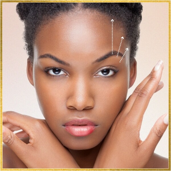 Brow lift in los Angeles