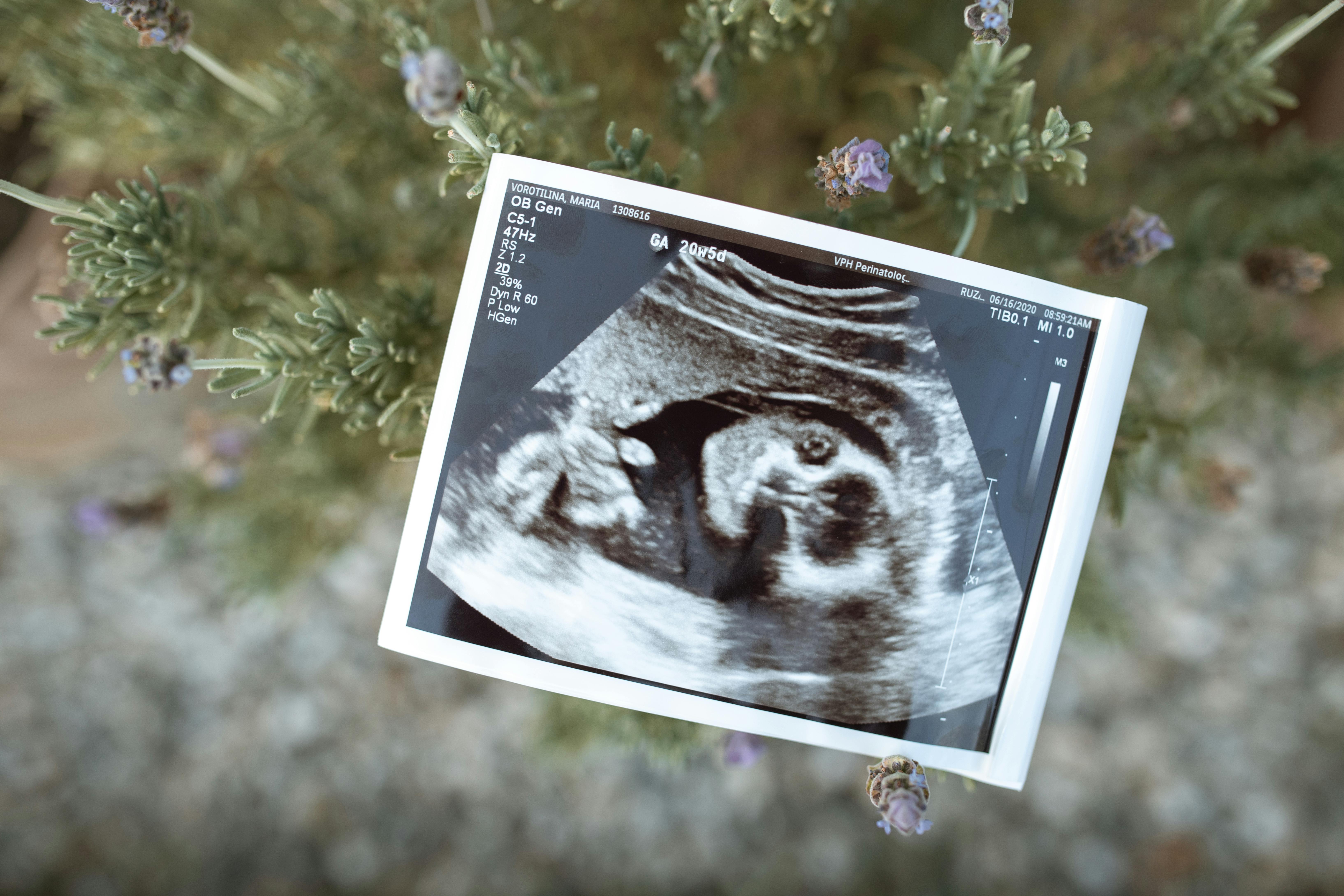 Frozen Orphans: The Children of Embryo Adoption
