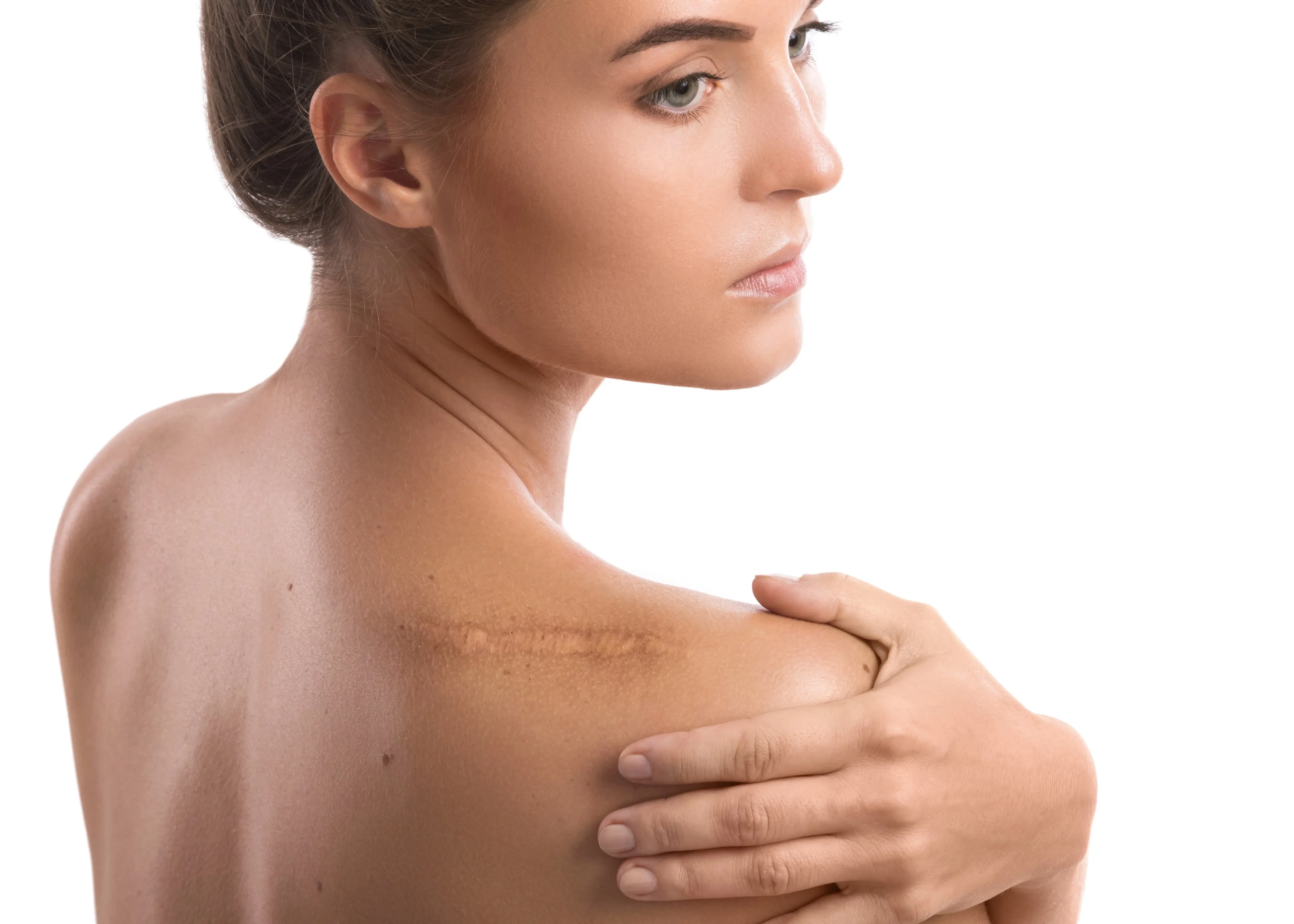 Scar Revision