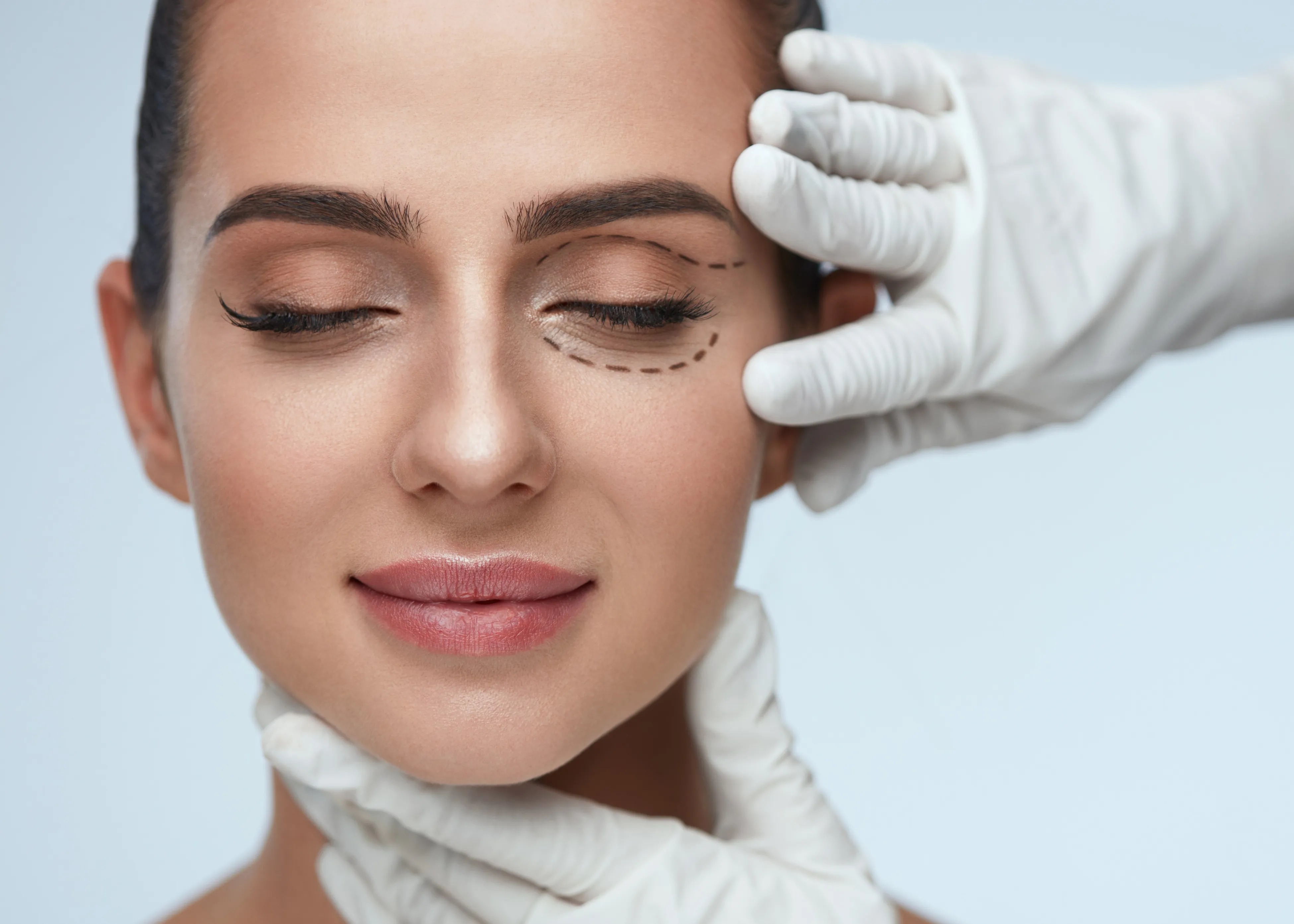 Blepharoplasty
