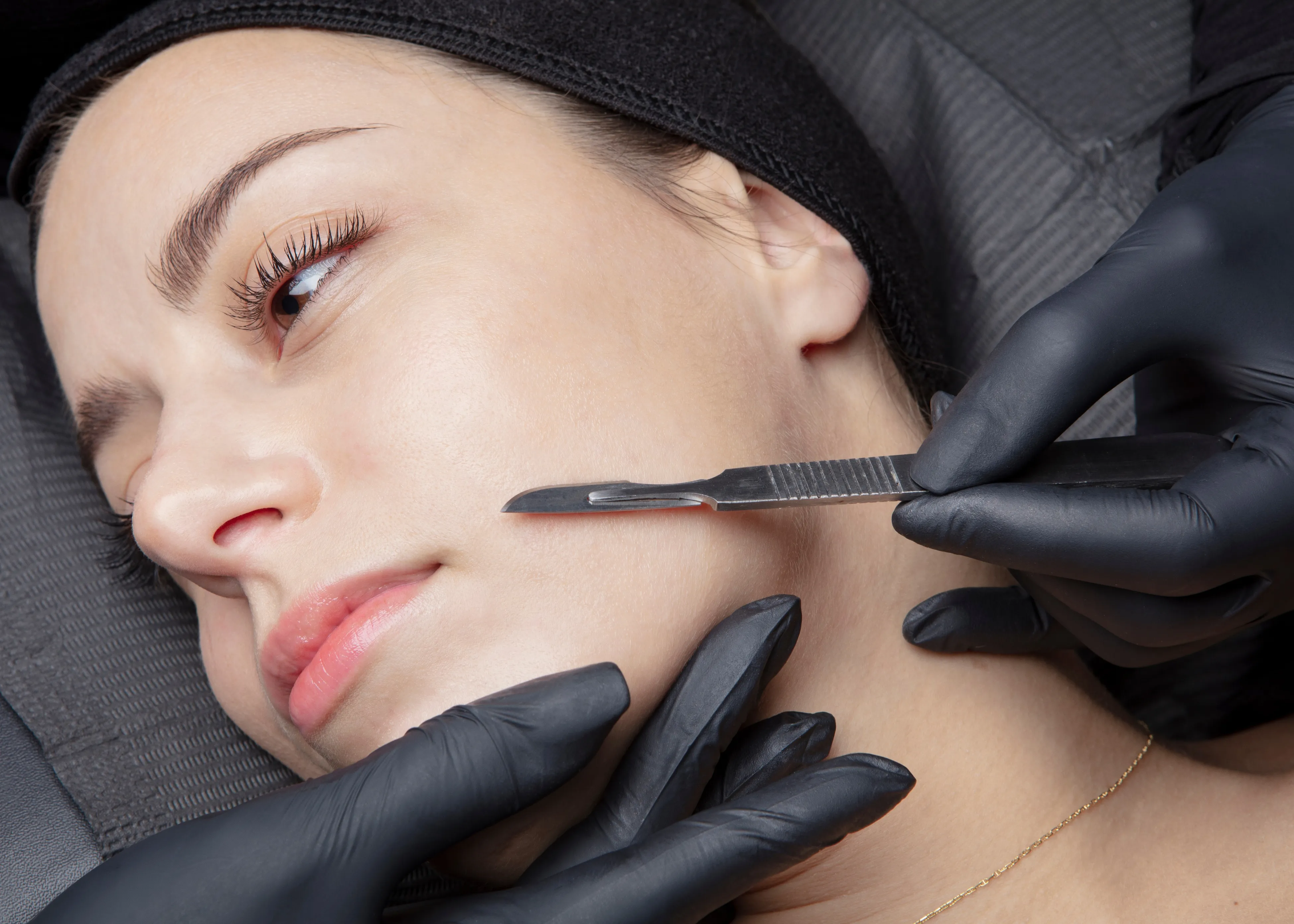 Dermaplaning