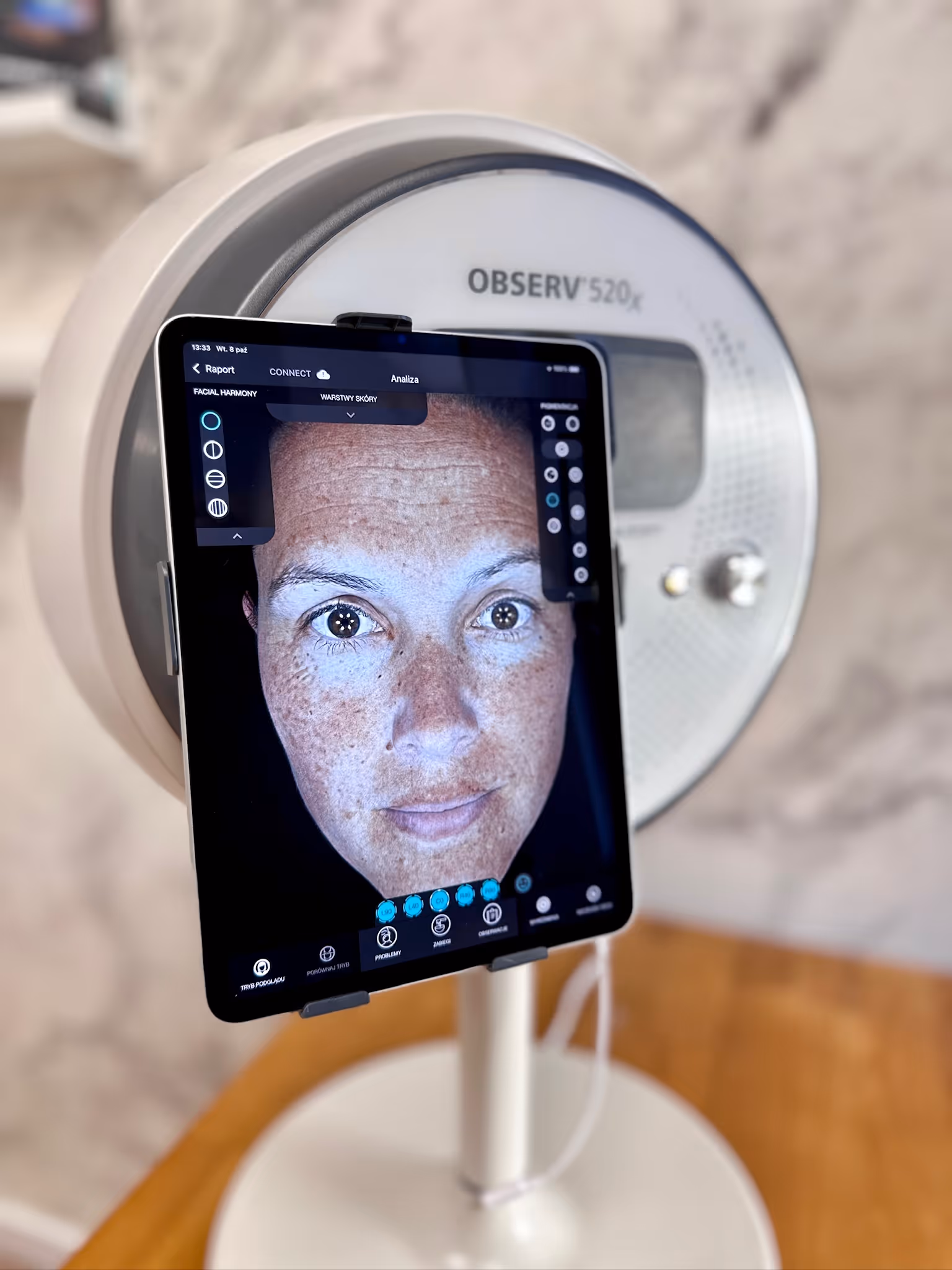 Skin analysis device displaying a close-up digital facial scan highlighting skin texture and pigmentation.