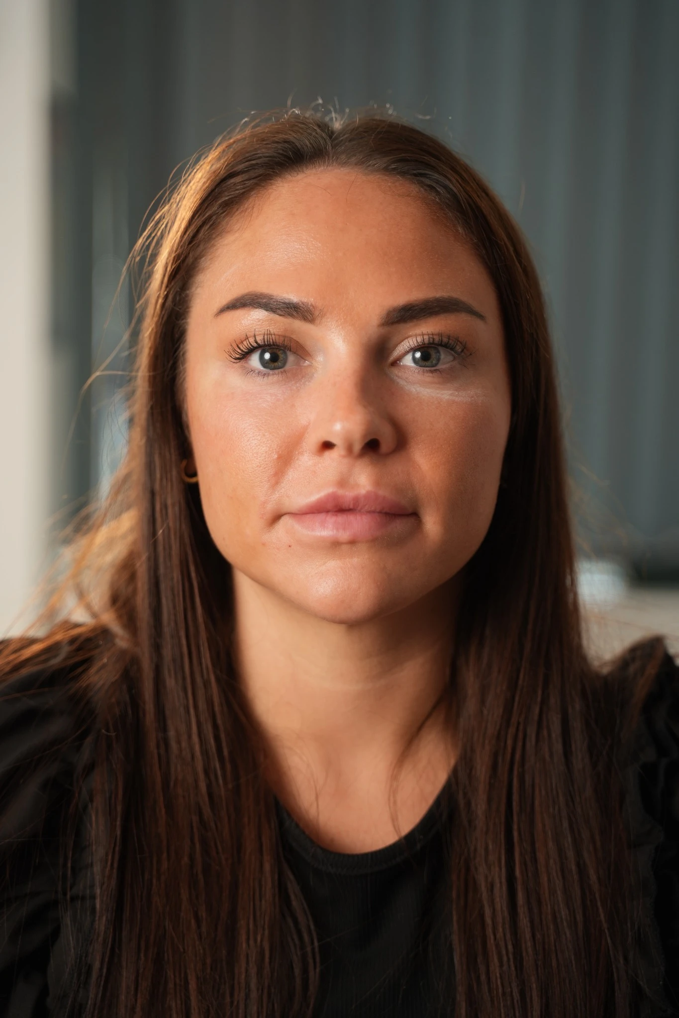 What is tear trough filler?