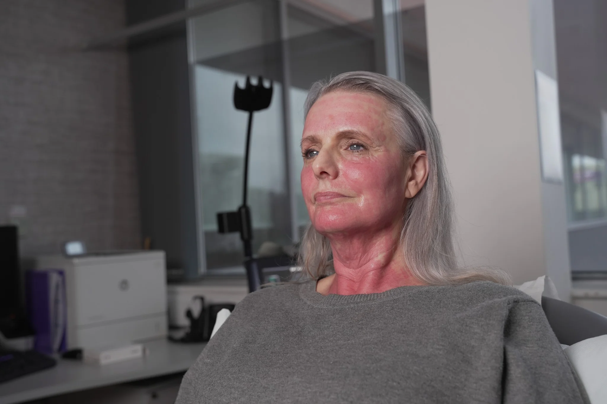 Anti Ageing treatment 50- 60 Leeds