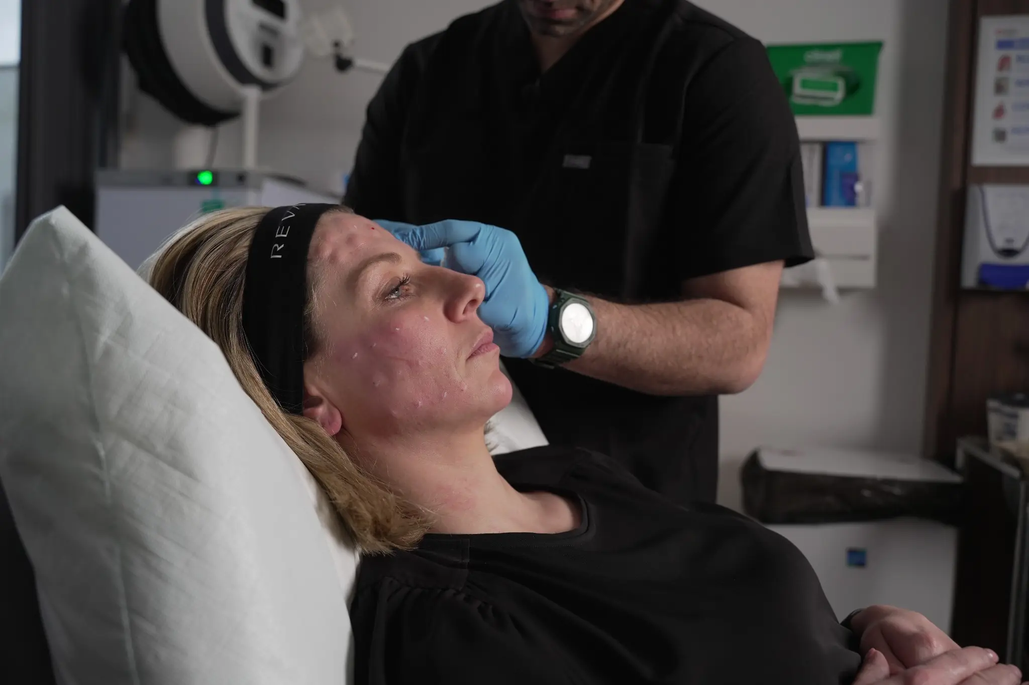 SuneKos v's Profhilo Leeds - What skin booster is better?