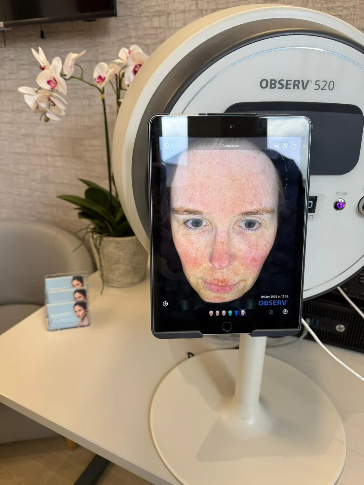 Observ Skin Analysis