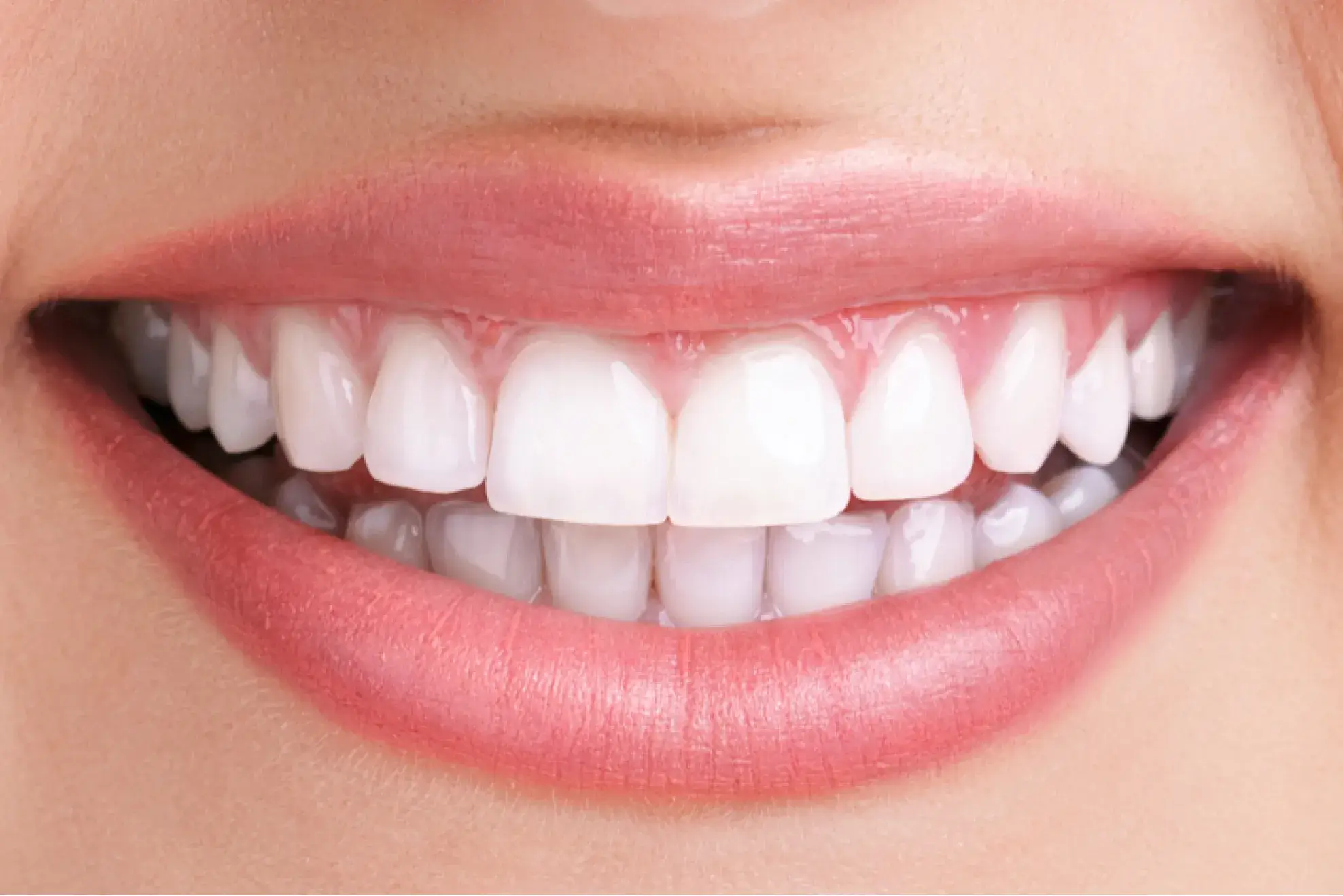 A close up of a woman's smile with white teeth.