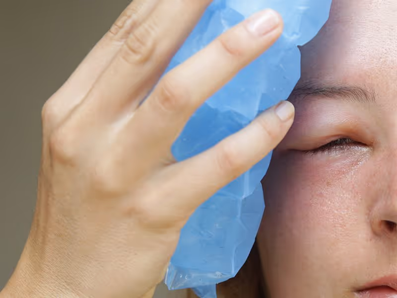wasp sting on the eye
