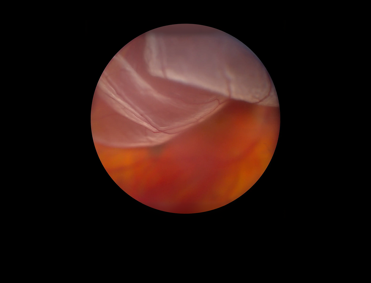 Close-up of red and orange tissue with translucent layers and fine blood vessels under a microscope.