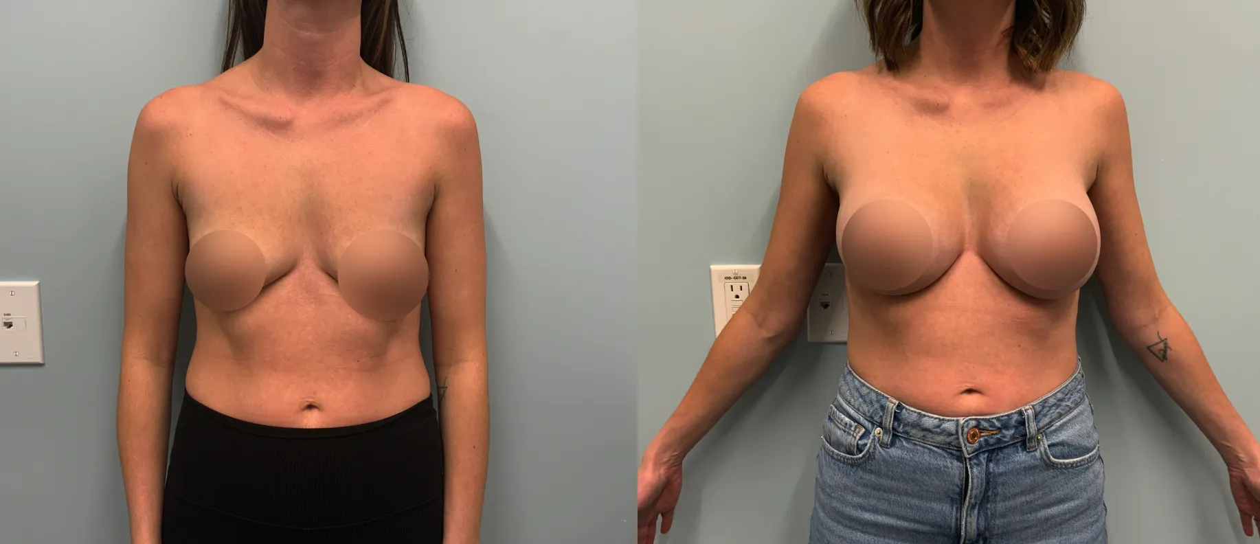 Patient Before and After