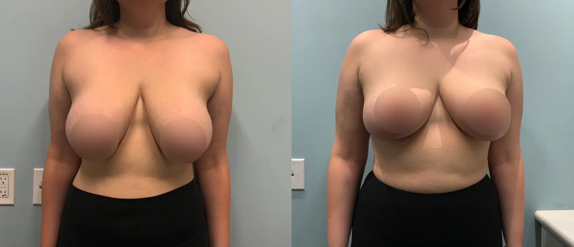 Patient Before and After