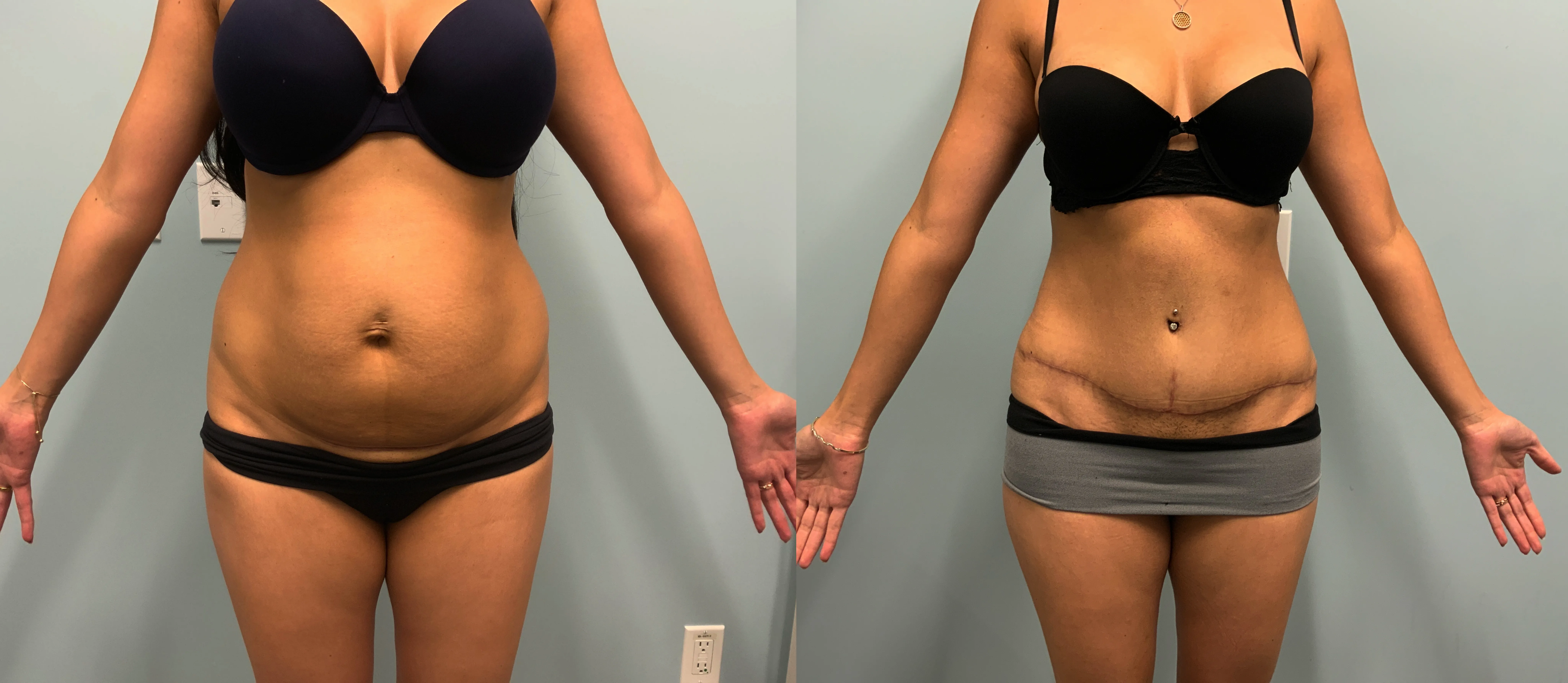 Patient Before and After