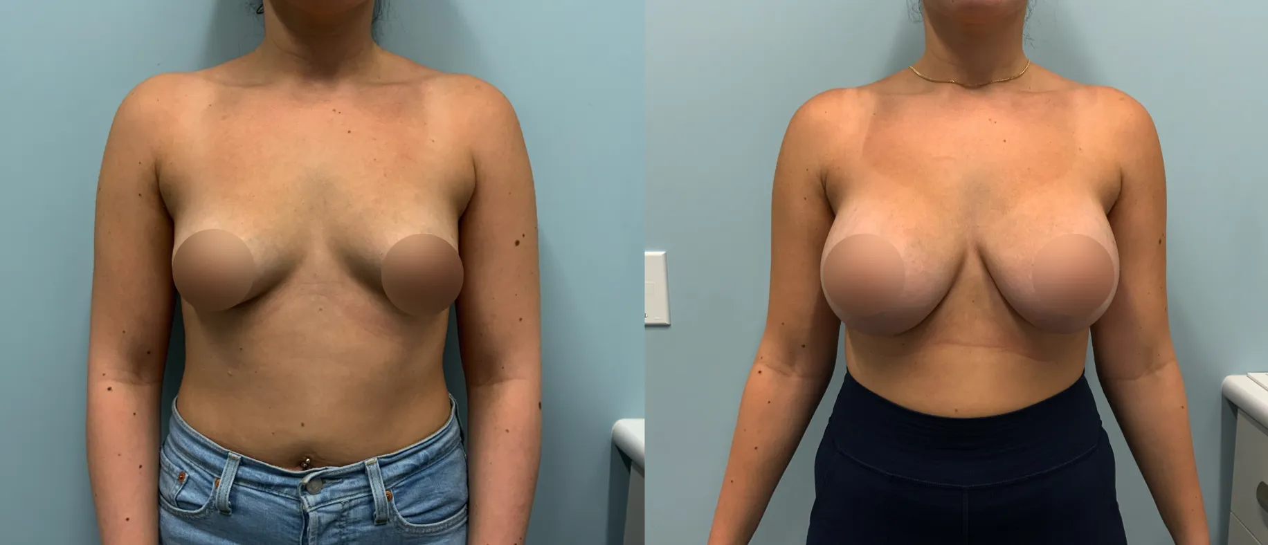 Patient Before and After