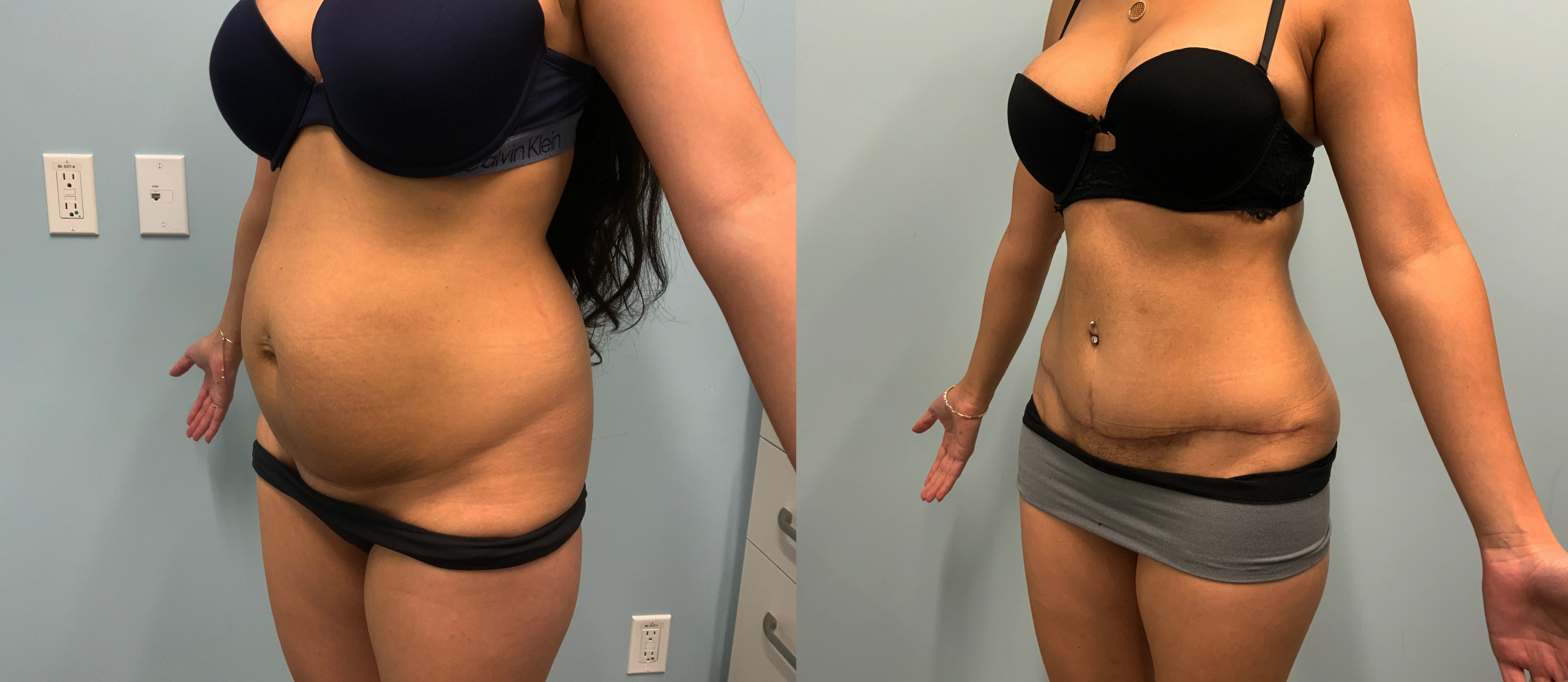 Patient Before and After