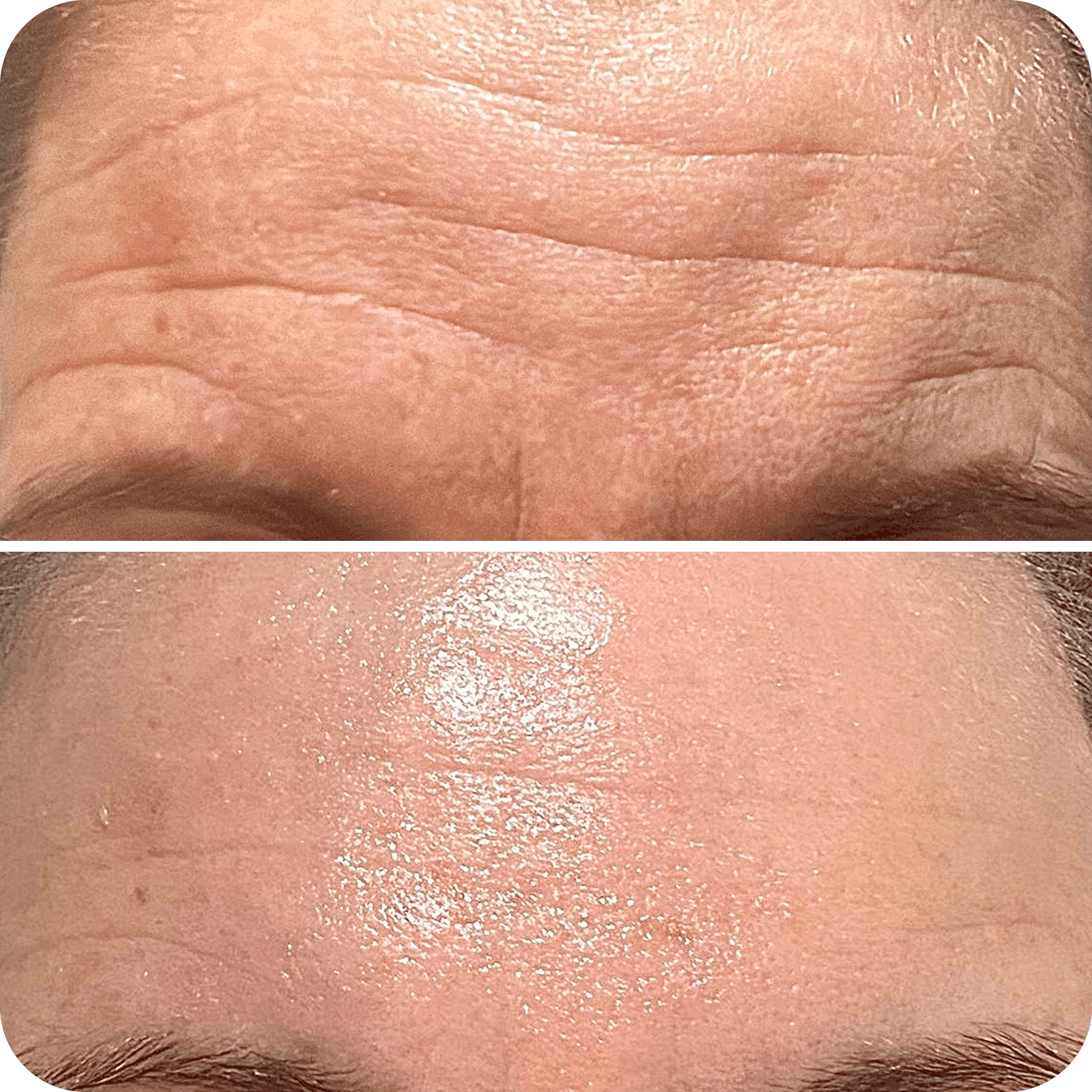 futuracontour_beforeandafter