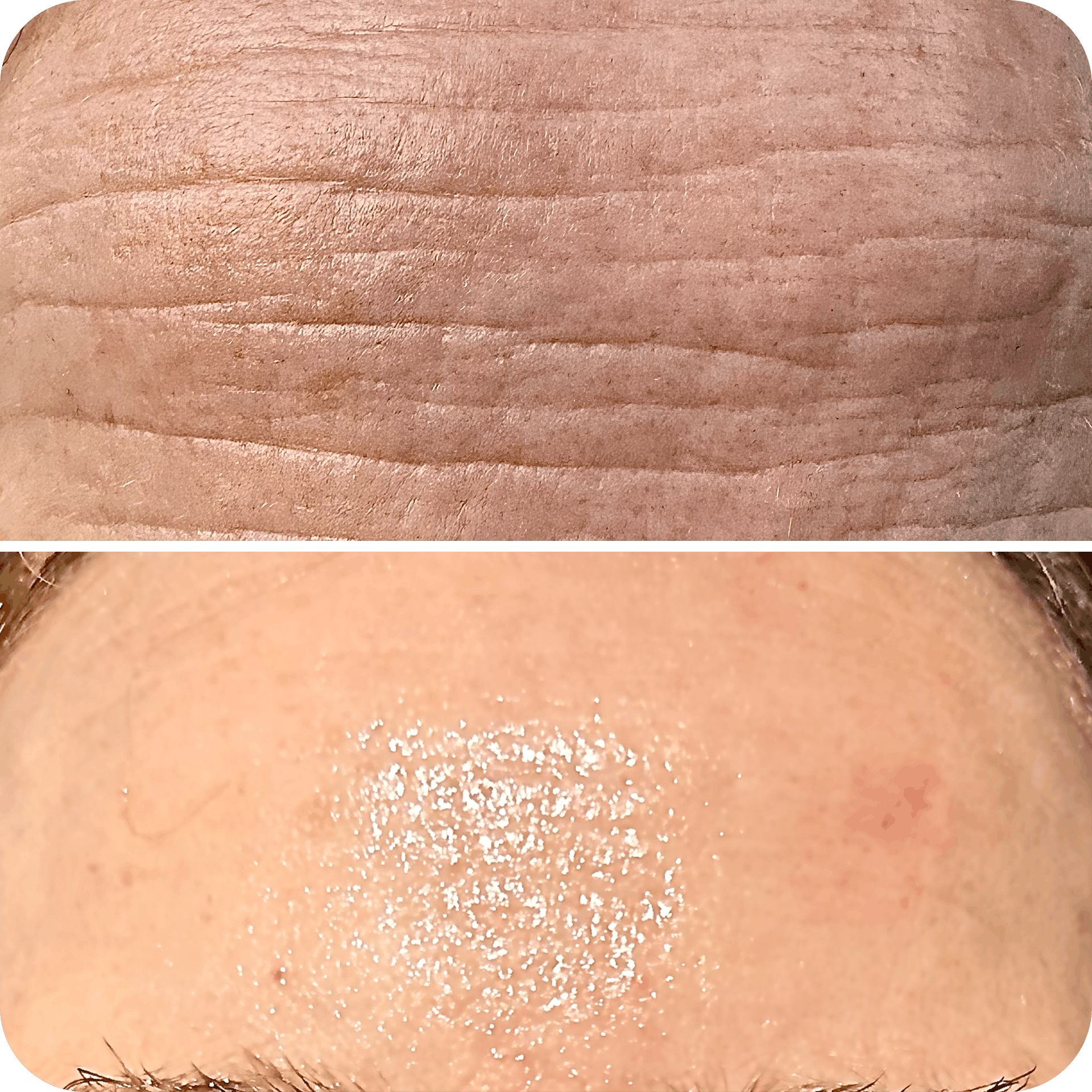 futuracontour_beforeandafter