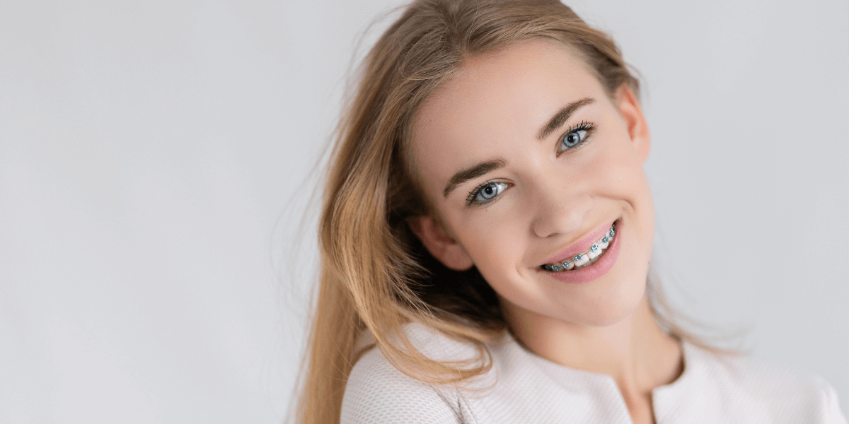 Orthodontics treatment using braces to align teeth