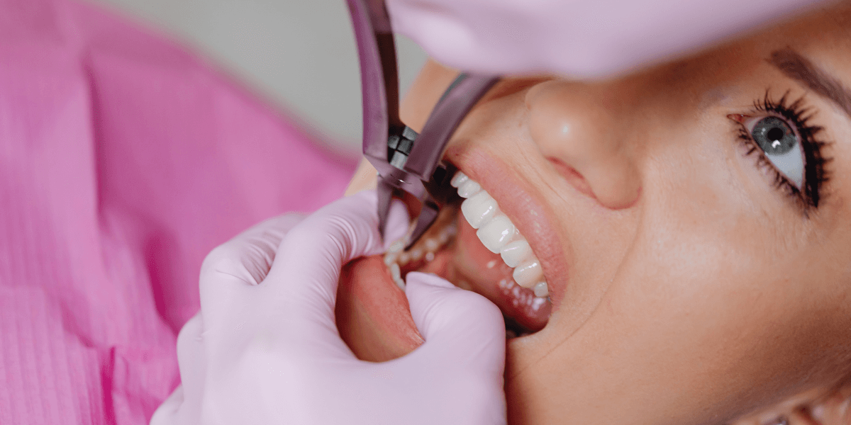 Dentist removing damaged tooth during extraction