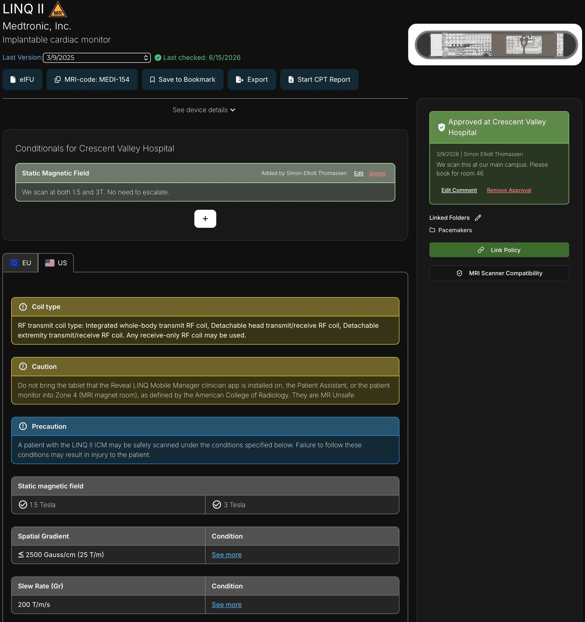 Review the complete implant record