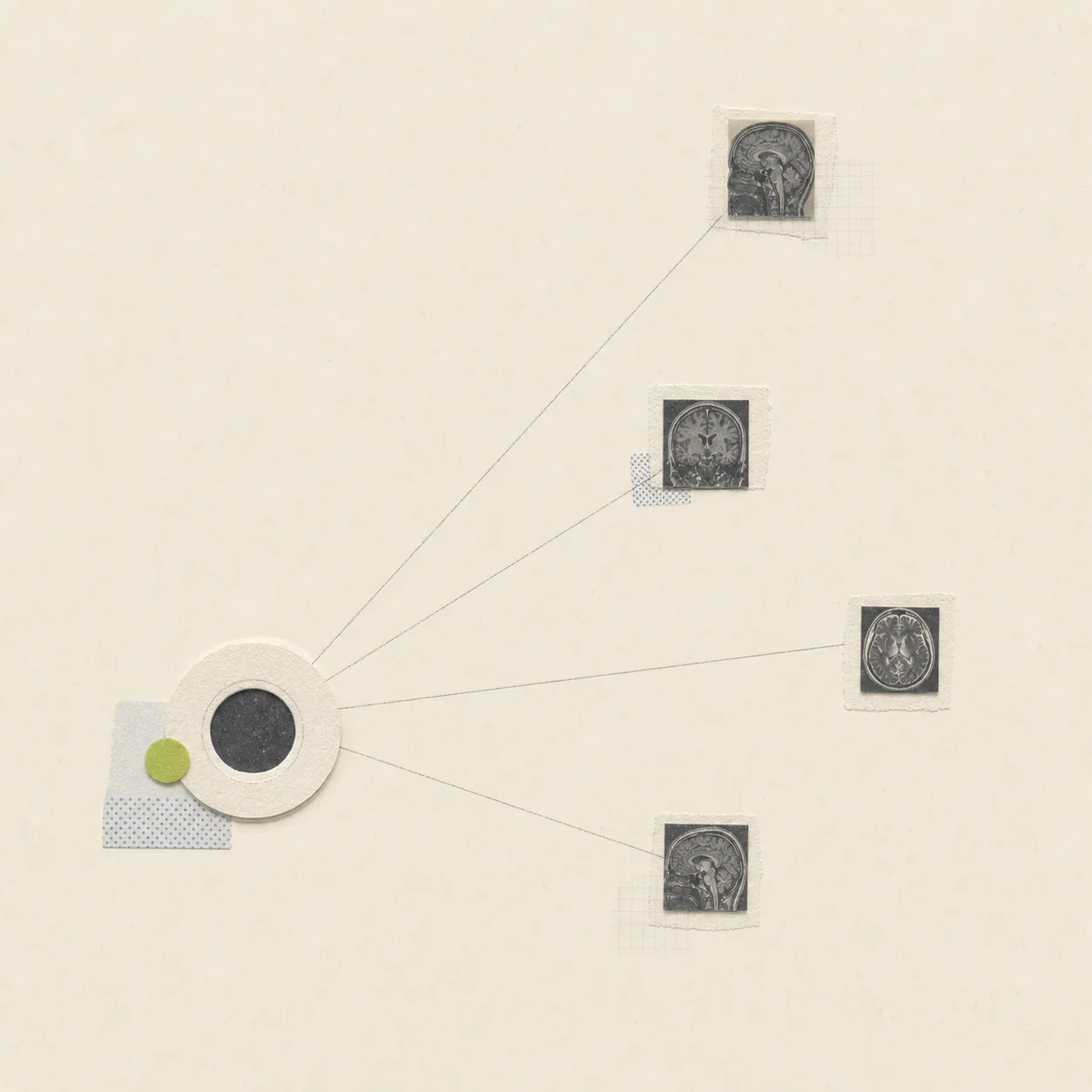 Diagram linking a central circle to four small MRI brain scan images on a cream background.