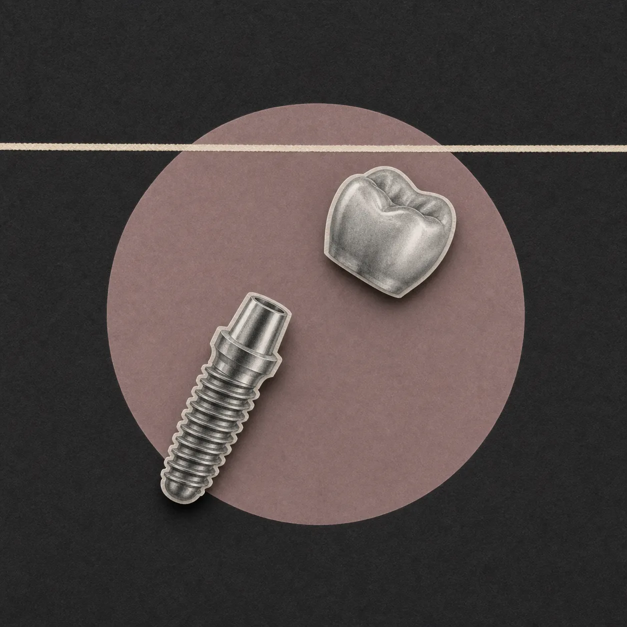 Dental implant showing the metal screw base and tooth-shaped crown components side by side.