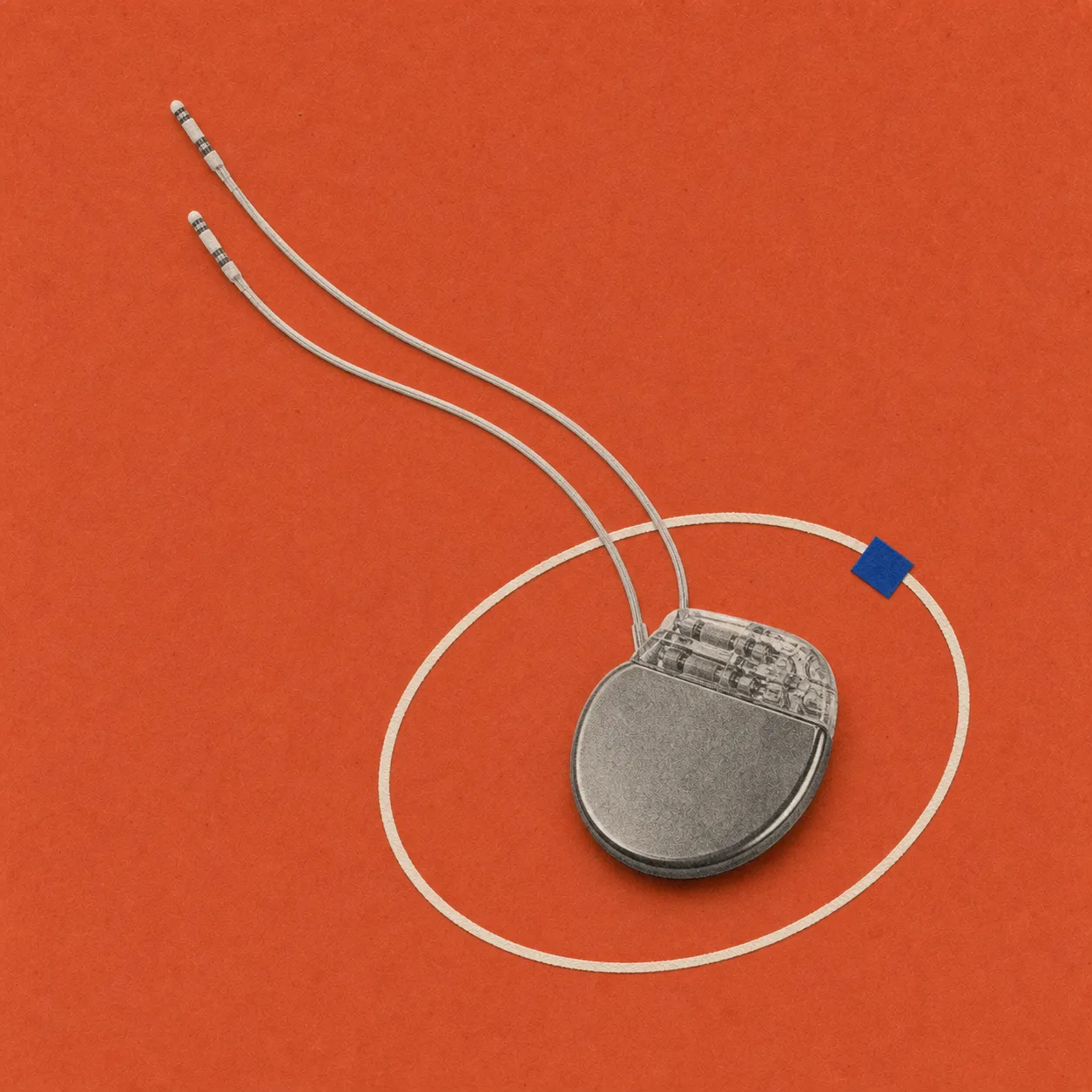 Medical pacemaker device with two leads on an orange background.