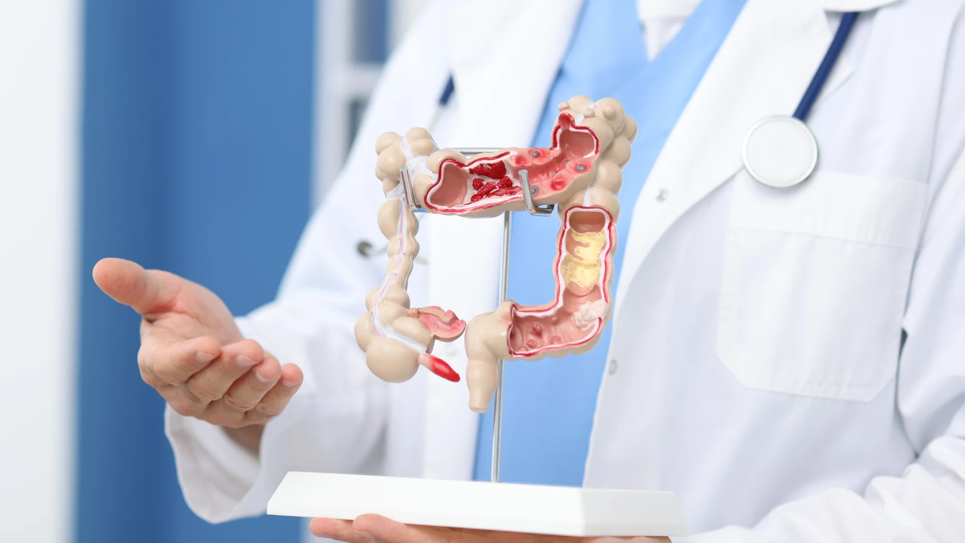 SYMBIOTYKA відкриває новий напрямок — гастроентерологію