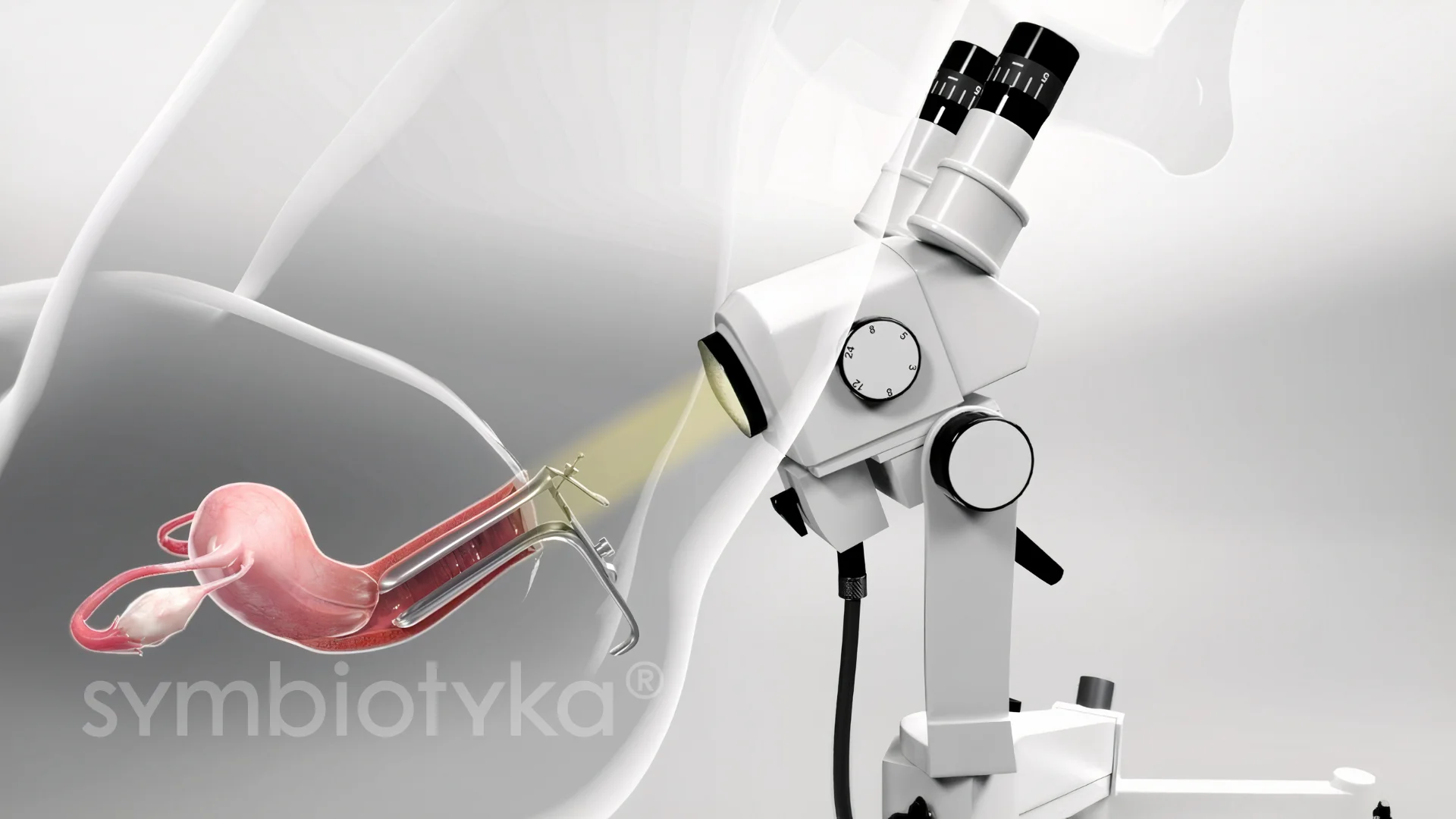 Кольпоскопія