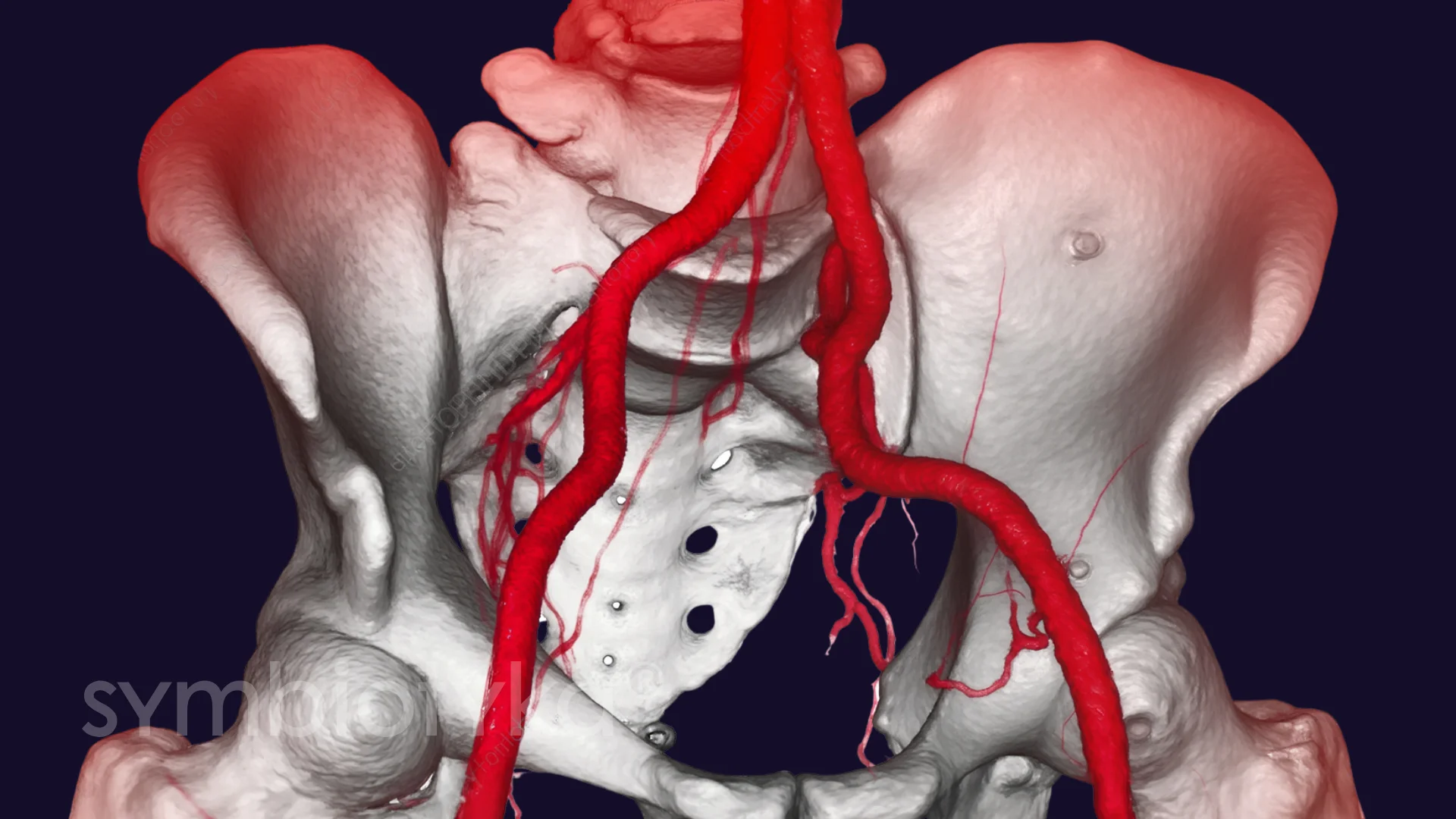 УЗД клубових артерій