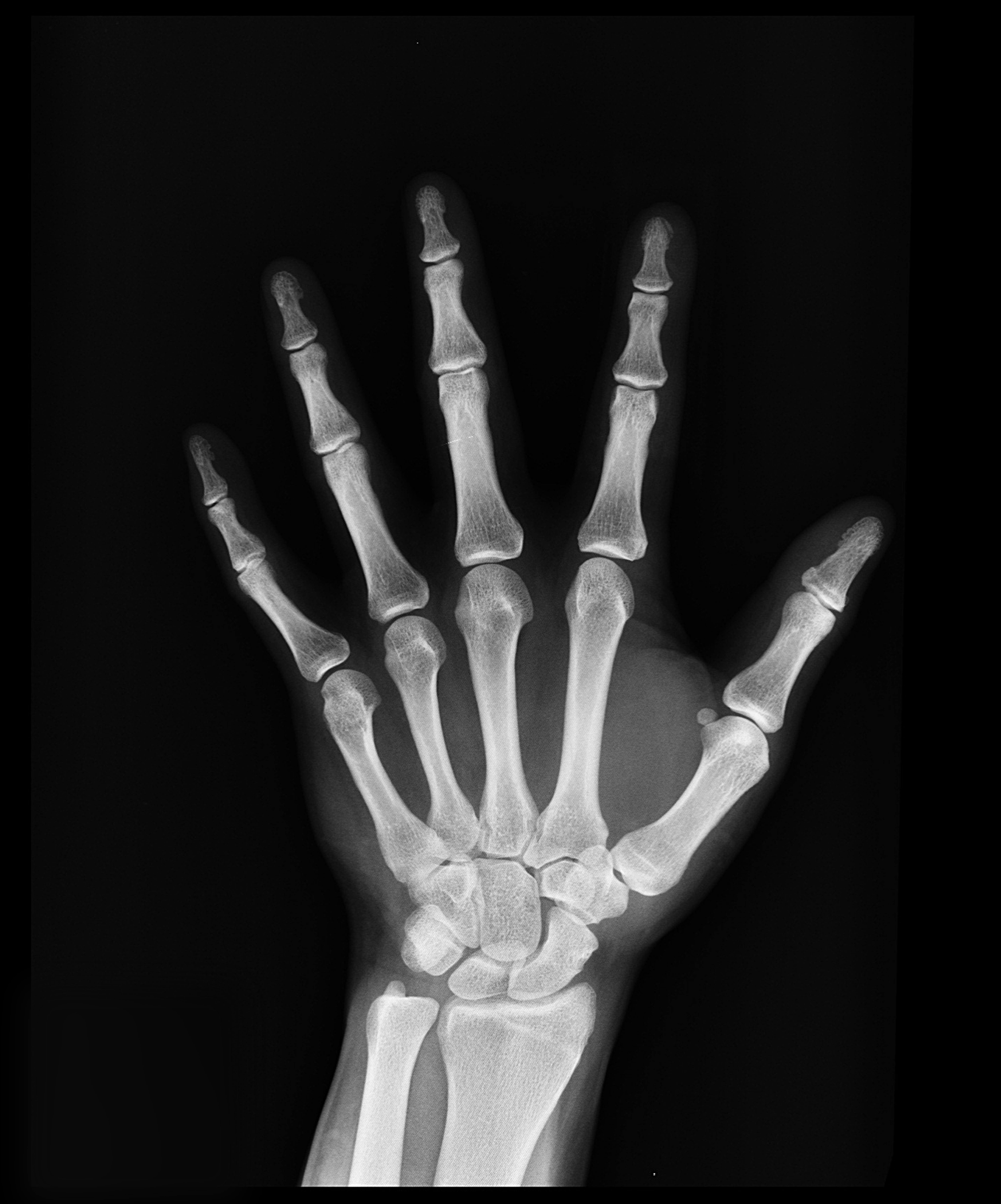 Discover expert best practices for annotating MRI, CT, and X-ray scans to train reliable radiology AI models. Improve diagnostic accuracy with precision labeling.