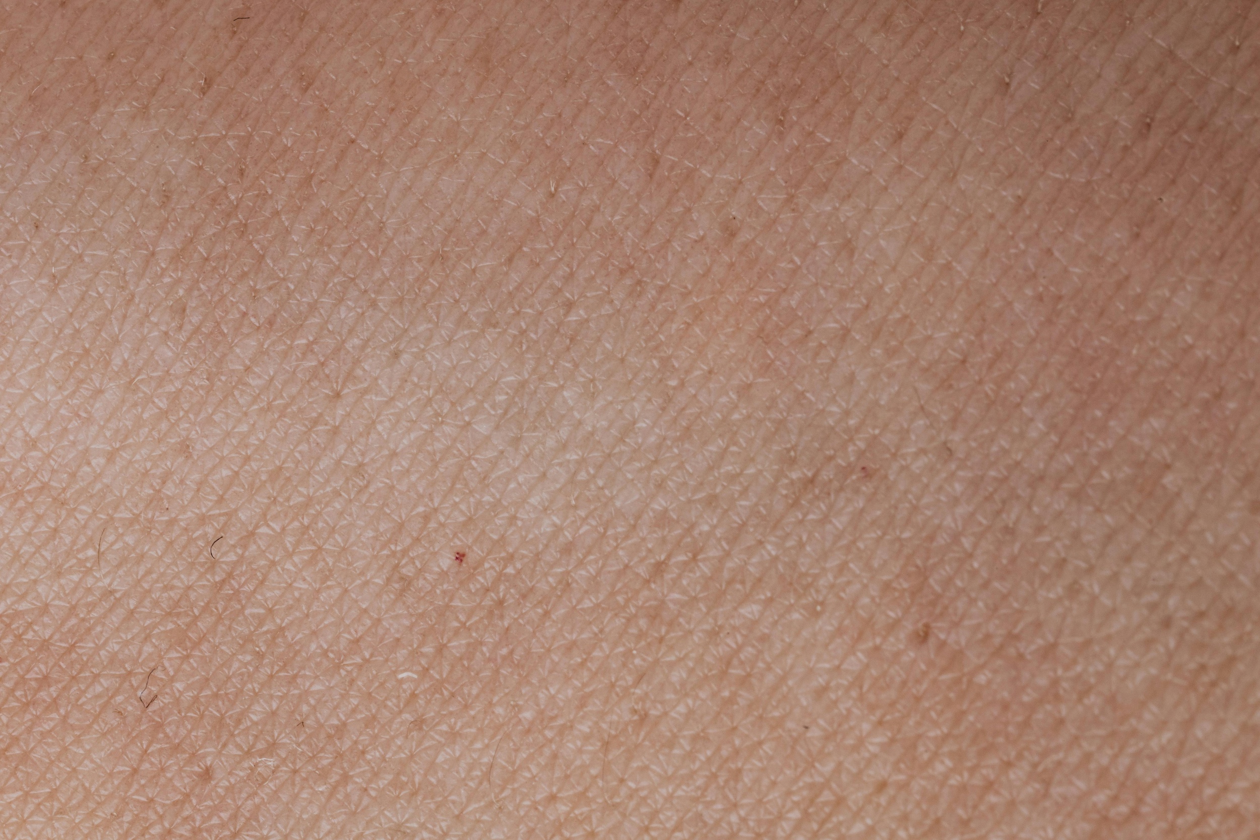 Discover how AI and image annotation are transforming dermatology by enabling accurate, scalable skin condition detection and diagnosis. Learn best practices, tools, and emerging trends.