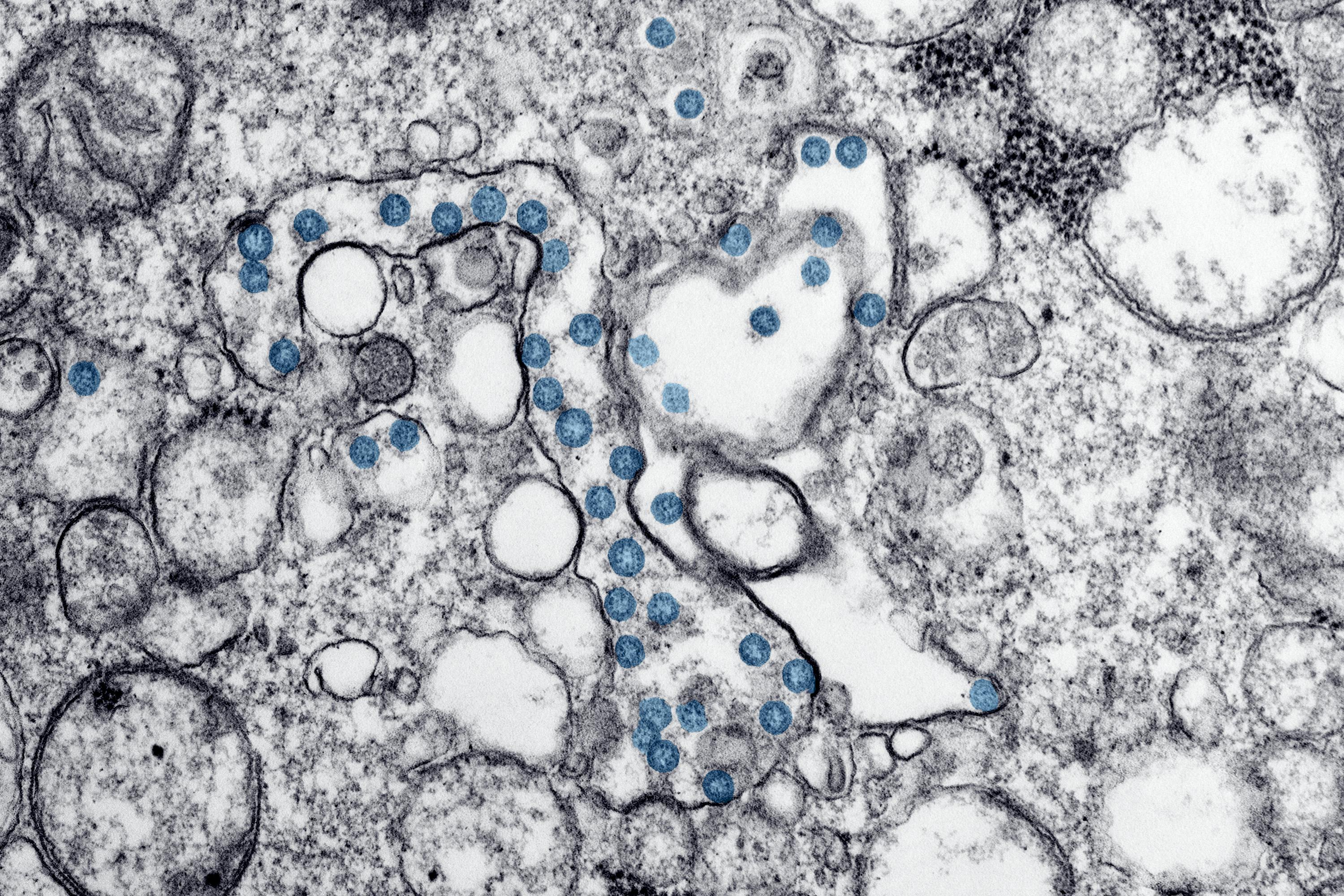 Explore how AI handles multi-class tumor segmentation in medical imaging. Learn best annotation strategies, tools, and solutions to overcome labeling challenges.
