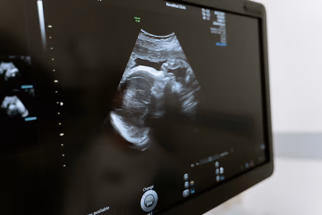 Ultrasound Annotation Services