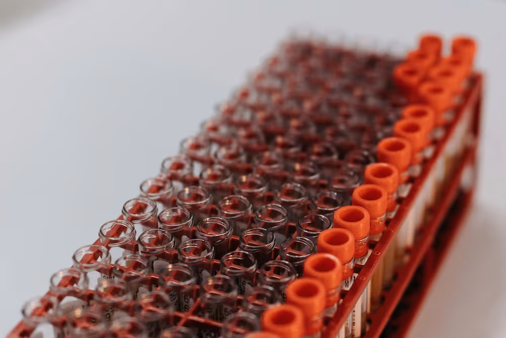 A comprehensive guide to white blood cell segmentation in AI, covering clinical workflows, data quality, challenges, and advanced deep learning methods.