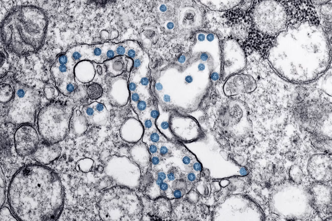Explore how AI handles multi-class tumor segmentation in medical imaging. Learn best annotation strategies, tools for AI teams.