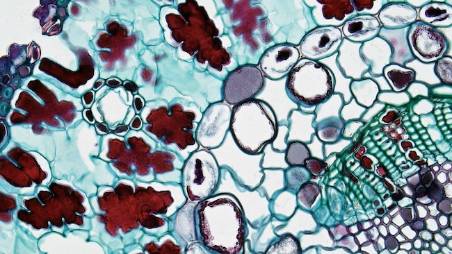 Pathology Annotation Services