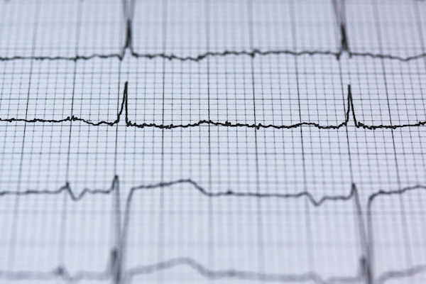 Services d'annotation de formes d'ondes médicales
