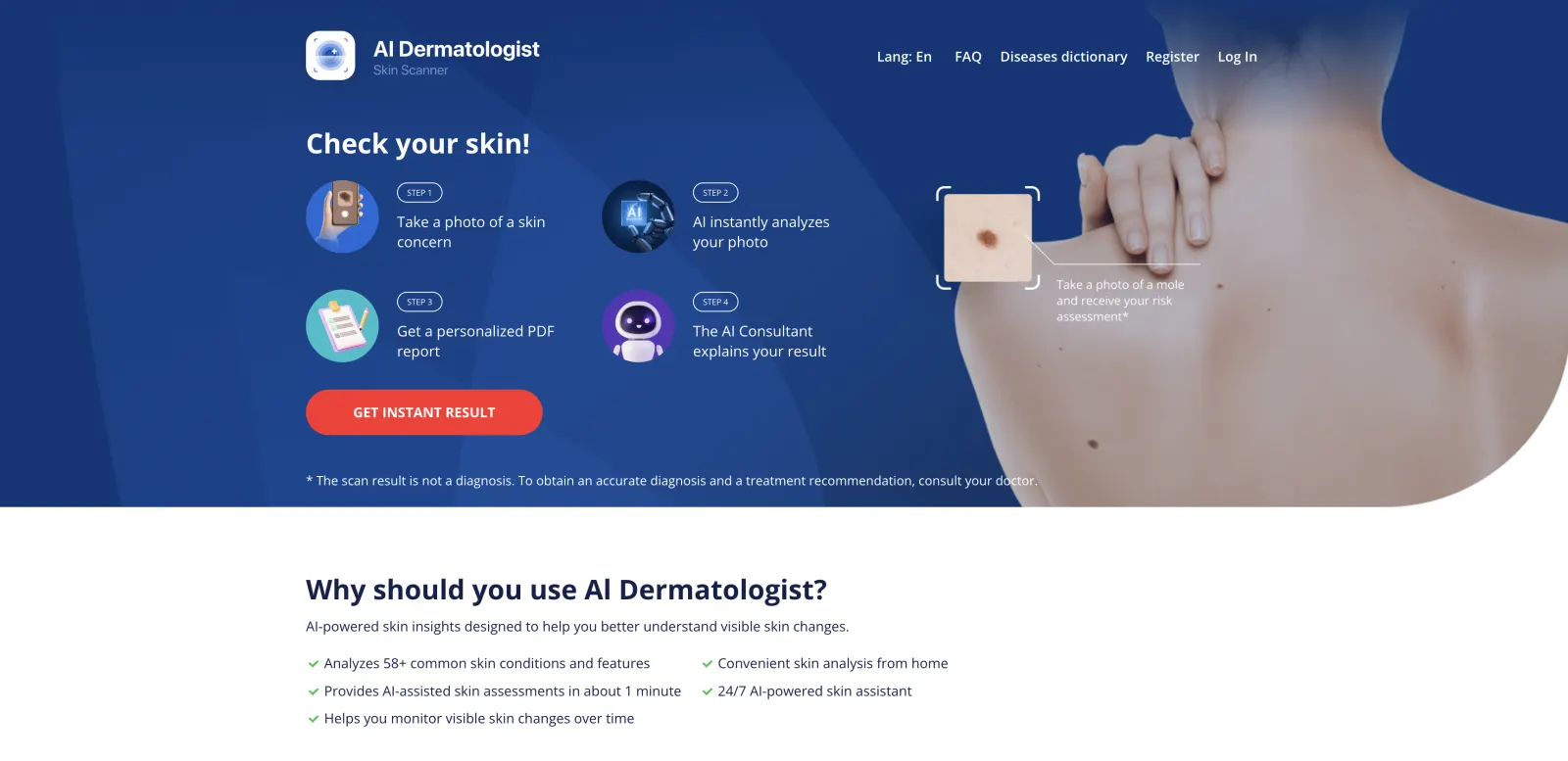 AI Dermatologist skin scanner