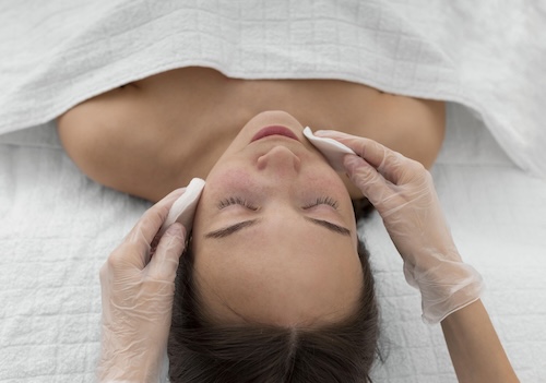 Aplicación de tratamiento con exosomas faciales en Clínica Vyctoria Logroño