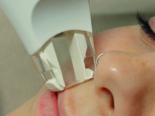 Cabezal Ergolift LPG Alliance 27 utilizado en tratamientos faciales de estética avanzada en Logroño