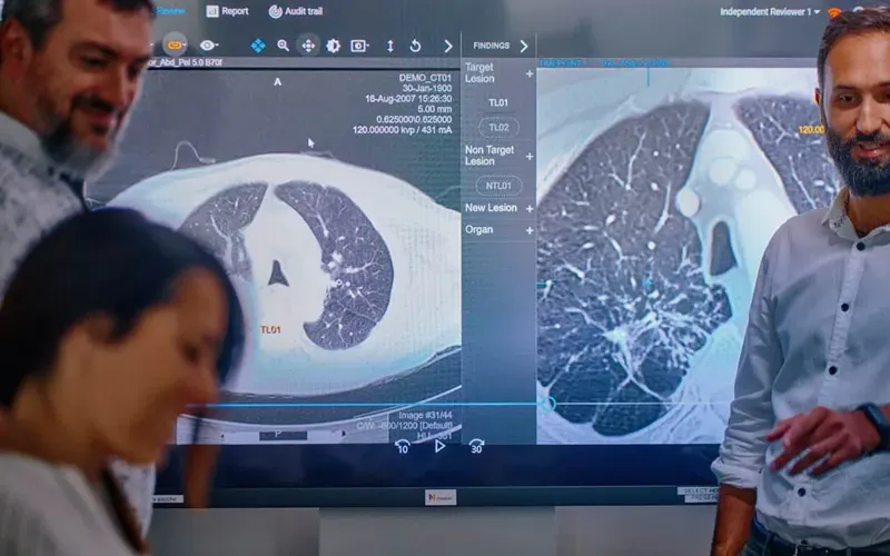 The Median Technologies team reviewing medical imaging scans
