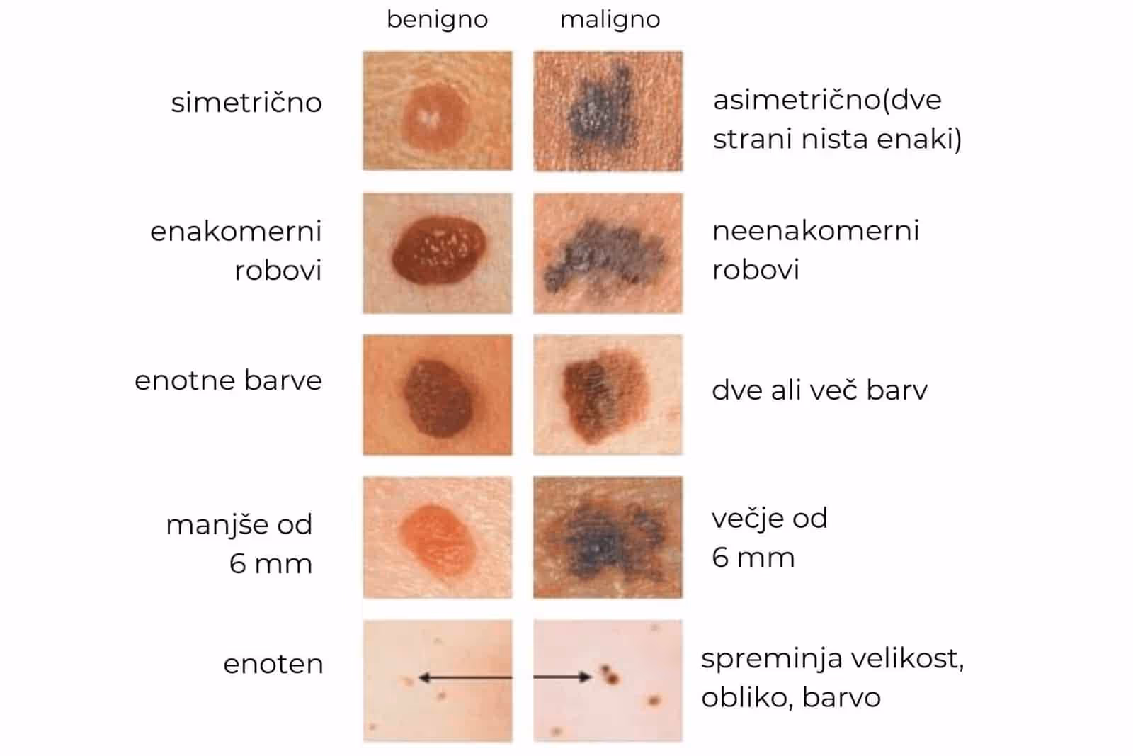 infografika Metoda ABCDE za pregled znamenj