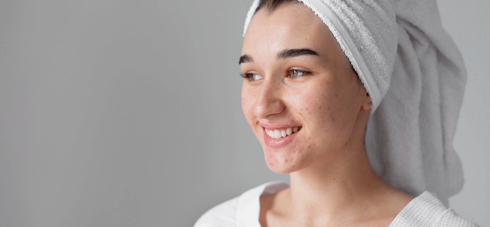 Woman with adult acne smiling after skincare routine, shown as an example of treatment results from the best dermatologist in Bend, OR.