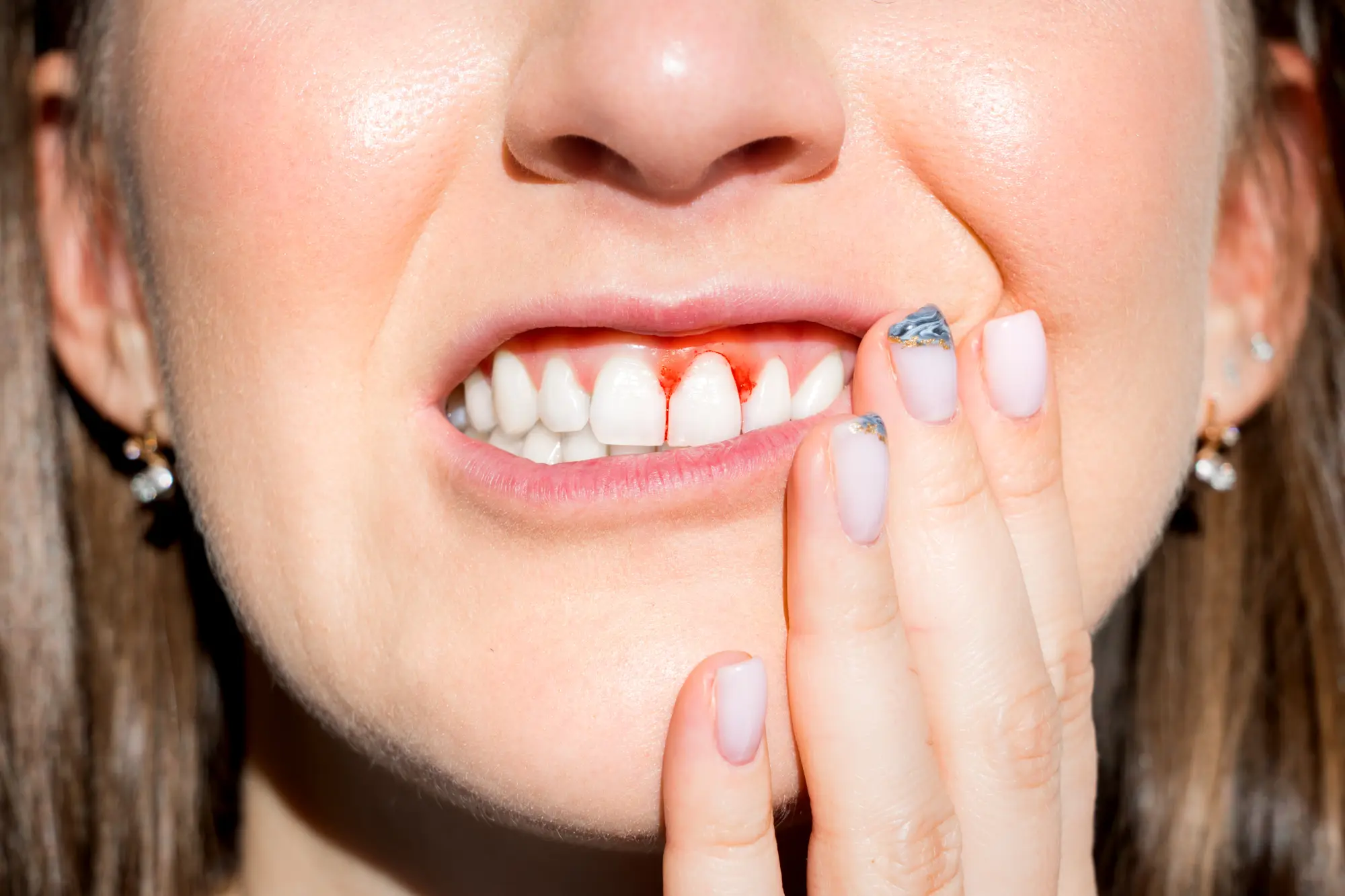 Can Periodontal Disease Be Reversed