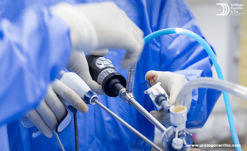 La penescopía es una prueba para detectar el VPH en hombres