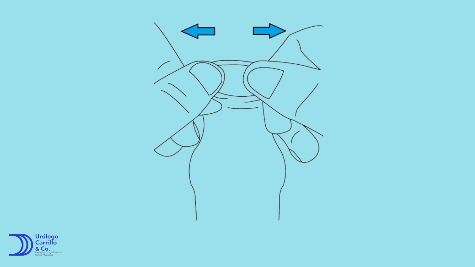 Ejercicios para Bajar el Prepucio y tratar la fimosis de manera natural
