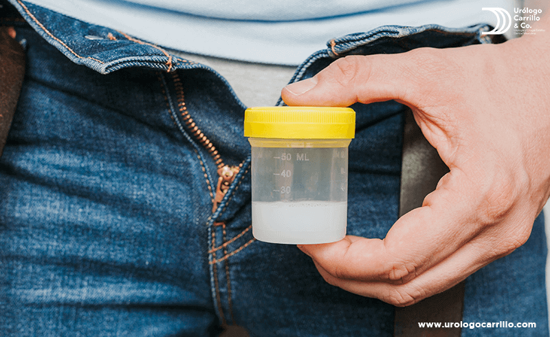 Una prueba de semen puede determinar la calidad de los espermatozoides